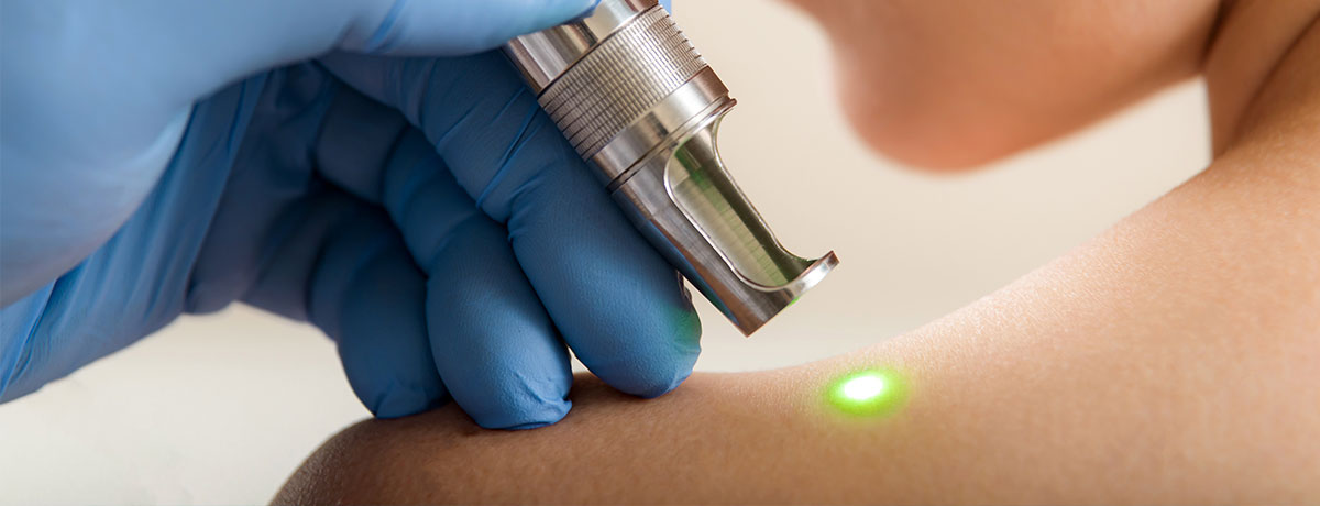 Laserowy anti-aging
