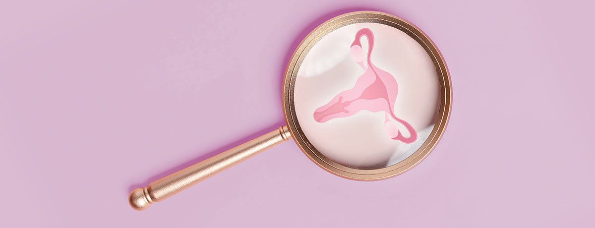 Ginekolog o trądziku PCOS Ginekolog o trądziku PCOS