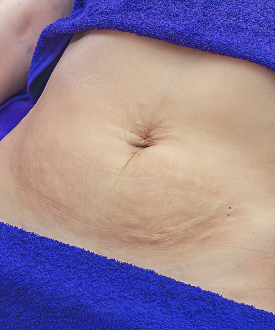 Nieusuwalne? Nieusuwalne?